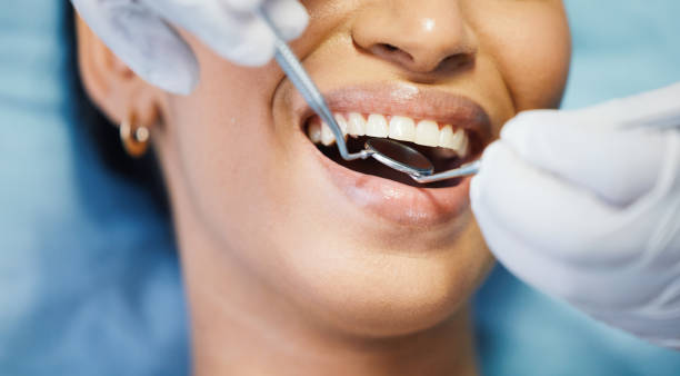 Best Emergency Dentist for Lost Fillings or Crowns in Molalla, OR